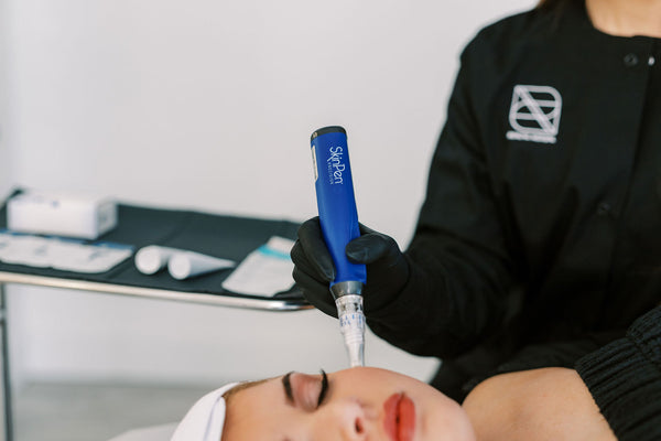 What To Expect: SkinPen Microneedling